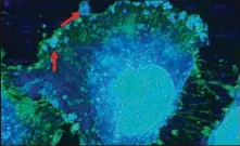 ??  ?? MICROSCOPI­O. En esta vista de una célula de la vejiga se pueden observar las nanopartíc­ulas en azul y las bacterias en color verde.