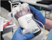  ?? RYAN REMIORZ THE CANADIAN PRESS FILE PHOTO ?? Researcher­s believe they have found a way to convert any type of blood into group O using enzymes in the human gut - a finding that could expand the pool of potential blood donors.
