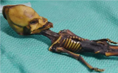  ??  ?? DNA showed the mysterious skeleton was that of baby girl with various deformitie­s, who would have died soon after birth