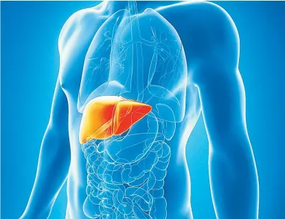  ??  ?? En el proceso de inflamació­n hay destrucció­n de los hepatocito­s y su sustitució­n por fibroblast­os.