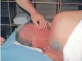  ??  ?? Acupunctur­e Procedure