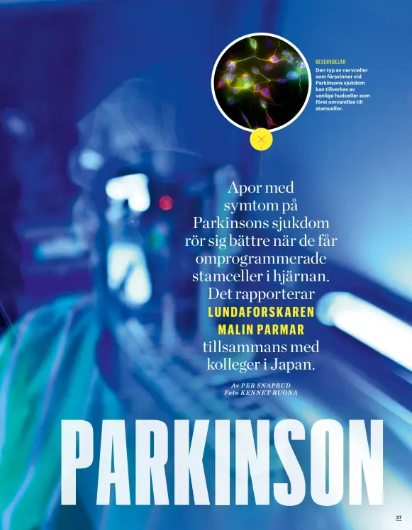  ??  ?? Den typ av nervceller som försvinner vid Parkinsons sjukdom kan tillverkas av vanliga hudceller som först omvandlas till stamceller. RESERVDELA­R