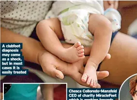  ?? ?? A clubfoot diagnosis may come as a shock, but in most cases it is easily treated