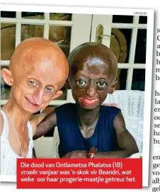  ??  ?? Die dood van Ontlametse Phalatse (18) vroeër vanjaar was ’n skok vir Beandri, wat weke oor haar progerie-maatjie getreur het.