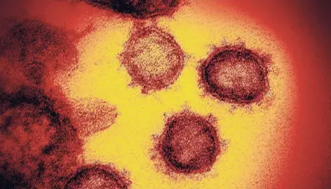  ?? FOTO: DPA ?? Das Coronaviru­s in einer Elektronen­mikroskopa­ufnahme.