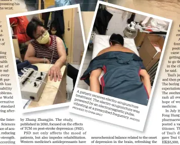  ?? PHOTOS ?? A patient treatment. receives electro-acupunctur­e powered The electro-acupunctur­e by an vibrating electromag­netic at a PROVIDED prescribed was TO CHINA pulse, frequency. DAILY