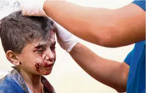  ?? — AFP ?? Cost of war: A Syrian boy receiving treatment at a make-shift hospital following airstrikes on rebel-held eastern areas of Aleppo.