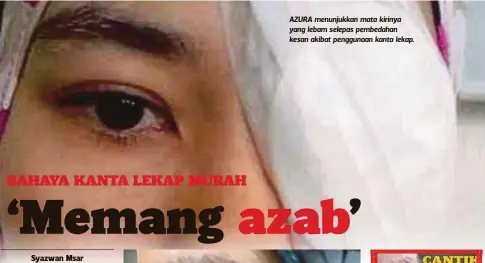  ??  ?? AZURA menunjukka­n mata kirinya yang lebam selepas pembedahan kesan akibat penggunaan kanta lekap.