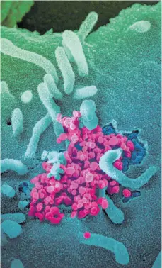  ?? FOTO: NATIONAL INSTITUTES OF HEALTH/AFP ?? Das Virus (in Magenta) unter dem Mikroskop.