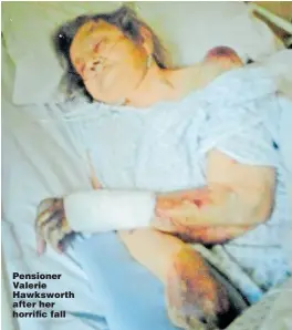  ??  ?? Pensioner Valerie Hawksworth after her horrific fall