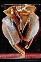  ?? Denton Cooley, M.D., via National Museum of American History via The New York Times ?? The first total artificial heart implanted in a human body in 1969, located at the National Museum of American History.