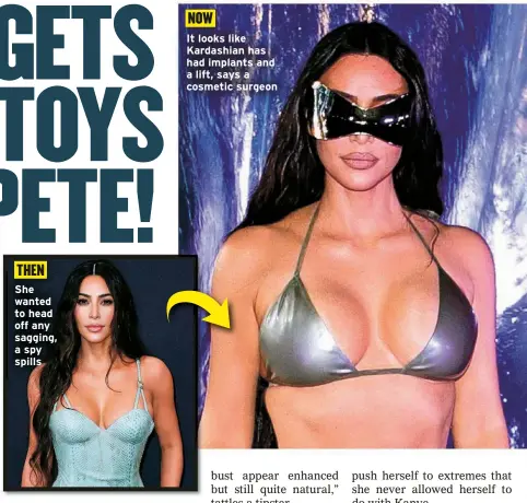  ?? ?? She wanted to head off any sagging, a spy spills
It looks like Kardashian has had implants and a lift, says a cosmetic surgeon