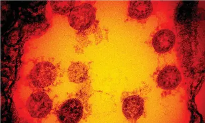  ?? Photograph: National Institute of Allergy an/AFP/Getty Images ?? A electron micrograph of the coronaviru­s. Scientists at Yale found that aberrant antibodies in patients with the disease wiped out helpful immune cells and attacked the body on multiple fronts.