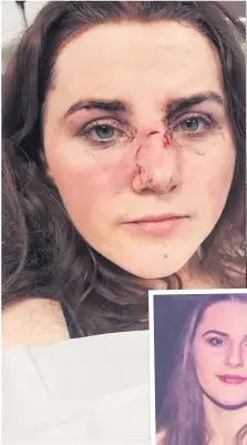  ??  ?? Katie Macdonald, 20, after above, and, inset, before the sickening attack