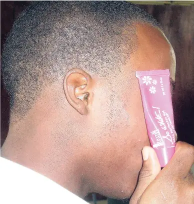  ?? FILE ?? A young man uses a tube of a popular bleaching cream to hide his face.