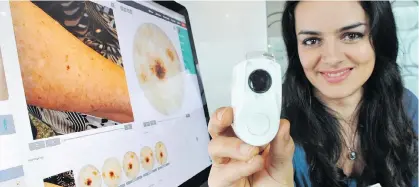  ?? WAYNE LEIDENFROS­T ?? Maryam Sadeghi is the developer of a molescope for dermoscopy that provides a detailed view of the skin.