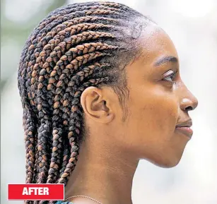  ??  ?? COVER UP: Aja Carthon (above) got a $20,000 rhinoplast­y and chin implant in August, then used the benefit of mask-wearing (below) to conceal post-op bruising and swelling. AFTER