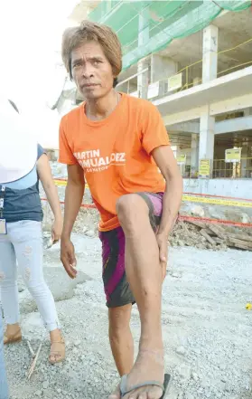  ?? SUNSTAR FOTO / ALLAN DEFENSOR ?? SLIGHT INJURY. Sario Sanico, 46, shows the gash he suffered when a scaffoldin­g colapsed at an ongoing constructi­on of building on M.J. Cuenco Ave. in Barangay Tejero, Cebu City.