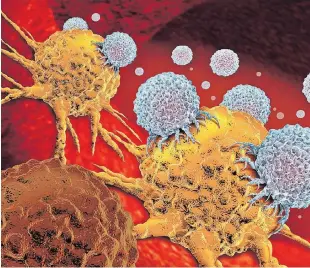  ?? ?? Bei der CAR-T-Zell-Therapie werden dem Patienten modifizier­te Immunzelle­n verabreich­t, die auf
