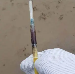  ??  ?? A needle full of blood which was found on Trecco Bay beach in Porthcawl