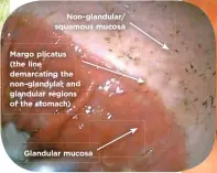  ??  ?? The equine stomach showing the non-glandular and glandular regions, and the margo plicatus