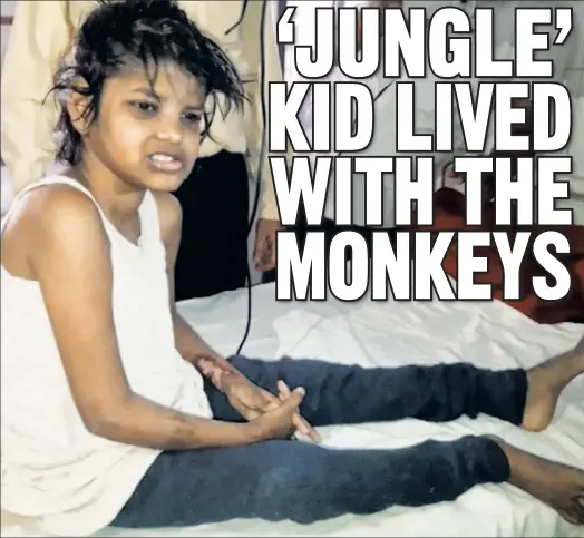  ??  ?? ON THE MEND: This 8-year-old Indian girl was found in the wild, where she was surviving with a group of monkeys — echoing “The Jungle Book.”