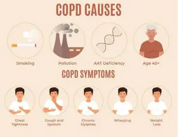  ?? ?? COPD is primarily caused by exposure to tobacco smoke, air pollution and occupation­al dust and chemicals.