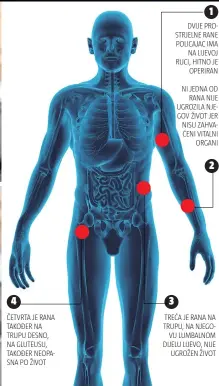  ??  ?? ČETVRTA JE RANA TAKOĐER NA TRUPU DESNO, NA GLUTEUSU, TAKOĐER NEOPASNA PO ŽIVOT TREĆA JE RANA NA TRUPU, NA NJEGOVU LUMBALNOM DIJELU LIJEVO, NIJE
UGROŽEN ŽIVOT
4
3
1
2
DVIJE PROSTRJELN­E RANE POLICAJAC IMA
NA LIJEVOJ RUCI, HITNO JE
OPERIRAN NI JEDNA OD
RANA NIJE UGROZILA NJEGOV ŽIVOT JER NISU ZAHVAĆENI VITALNI
ORGANI