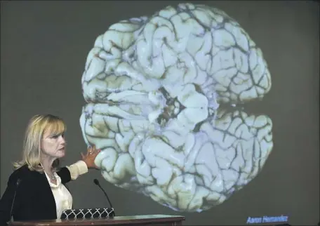  ?? Steven Senne Associated Press ?? NEW CTE research shows that the “subconcuss­ive” hits to the head that many athletes endure are more worrisome than players, parents and physicians have been led to believe. Above, neuropatho­logist Ann McKee discusses the brain of late NFL player Aaron...