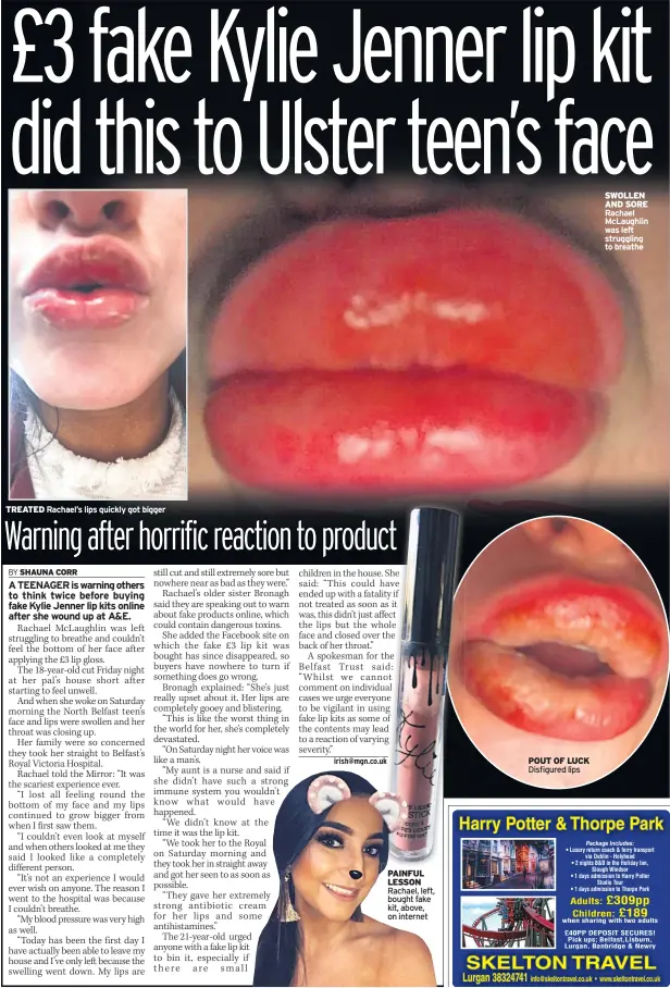  ??  ?? TREATED Rachael’s lips quickly got bigger PAINFUL LESSON Rachael, left, bought fake kit, above, on internet POUT OF LUCK Disfigured lips SWOLLEN AND SORE Rachael Mclaughlin was left struggling to breathe