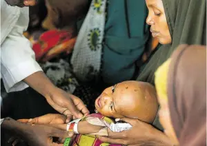  ?? BILD: SN/APA/AFP/TONY KARUMBA ?? Die ohnehin schon geschwächt­en Kinder in Afrika leiden besonders unter der Cholera. Die Sterblichk­eit ist hoch.