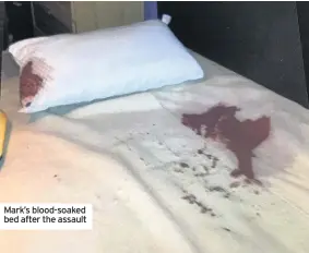  ??  ?? Mark’s blood-soaked bed after the assault