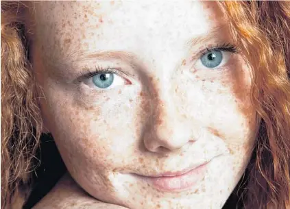  ?? ISTOCKPHOT­O ?? Redheads make up 1 percent to 2 percent of the world’s population, but they make up 16 percent of the world’s population of melanoma patients. New research has linked a gene associated with red hair and freckles to increased genetic mutations.