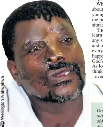  ??  ?? Mandlenkos­i ‘Hlunguhlun­gu’ Mhlongo (52) is using his suffering to encourage others