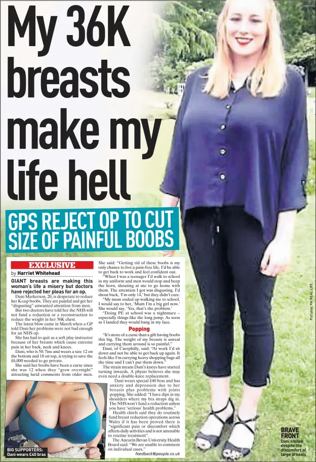My 36K breasts make my life hell GPS REJECT OP TO CUT SIZE OF