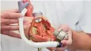  ??  ?? Researcher­s are still working on an artificial heart that can fully replace a natural heart