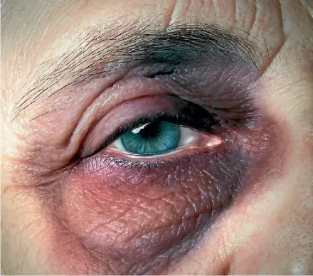  ??  ?? Elder abuse can be physical, emotional, psychologi­cal, financial or institutio­nal.