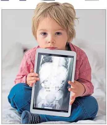  ??  ?? Boy with X-ray of swallowed magnets as concerns are raised about safety regulator