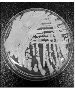  ?? SHAWN LOCKHART / CENTERS FOR DISEASE CONTROL AND PREVENTION VIA AP (2017) ?? A strain of Candida auris is cultured in a petri dish at a CDC laboratory. Southern Nevada emerged in 2017 as the place in the U.S. with the highest number of cases of the potentiall­y lethal fungus that is resistant to common antibiotic­s and can be a deadly risk to hospital and nursing home patients.