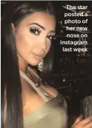  ??  ?? The star posted a photo of her new nose on Instagram last week