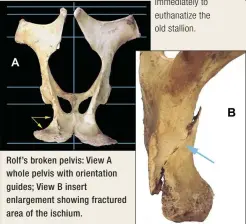  ??  ?? Rolf’s broken pelvis: View A whole pelvis with orientatio­n guides; View B insert enlargemen­t showing fractured area of the ischium.