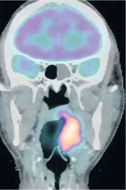  ??  ?? > Experts say the innovative medical imaging technique has the potential to greatly improve the accuracy and targeting of radiothera­py