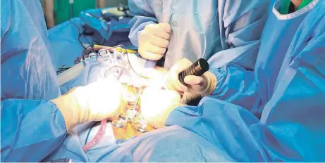  ?? ?? Médicos especialis­tas en cirugía y ortopedia participan en una operación a un paciente con escoliosis.