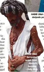  ??  ?? HABIB Ullah hidup terasing kerana dipulau oleh orang ramai kesan daripada penyakitny­a. - Daily Mail HABIB Ullah
bersyukur wajah tidak dipenuhi benjolan. - Daily Mail