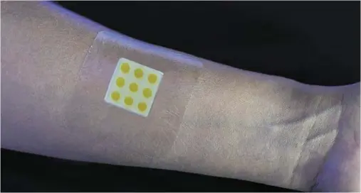  ??  ?? WARNING SIGN: Scientists have developed a plaster which changes colour when a wound becomes infected enabling quick treatment