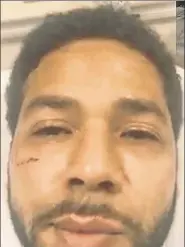  ??  ?? Faker: A screen grab shows Smollett after his “attack.”
