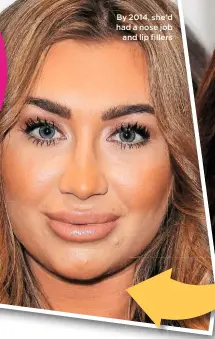  ??  ?? By 2014, she’d had a nose job and lip fillers