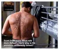  ??  ?? Scars in his eyes: What role does Rafael’s injury play in his presence on Ramsay Street?