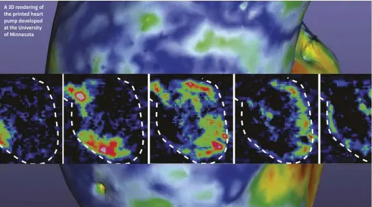  ??  ?? A 3D rendering of the printed heart pump developed at the University of Minnesota