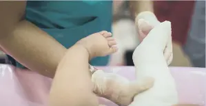  ?? ?? An infant with clubfoot being treated.